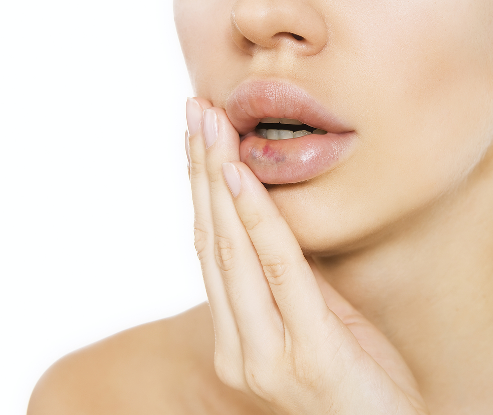 Ошибки косметолога губы